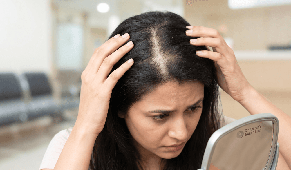 Best Dermatologist in Coimbatore for Hair Loss Treatment – Complete Expert Guide